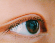 倒睫是由什么原因引起的？