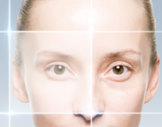 祛眼袋手術項目介紹